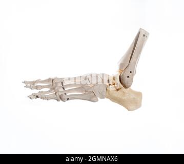 Außenansicht des Skeletts eines gelenkten menschlichen Fußes, mit dem distalen Teil des Schienbeins und der Fibel auf Draht montiert. Anatomiekonzept Stockfoto