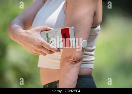 Diabetikerin überwacht und überprüft den Blutzuckerspiegel mit einem Fernsensor und einer neuen Technologie mit einer App im Smartphone Stockfoto