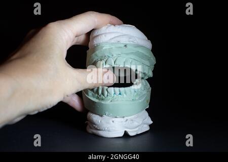 Hand halten Gips Dental-Modell der menschlichen Zähne. Stockfoto
