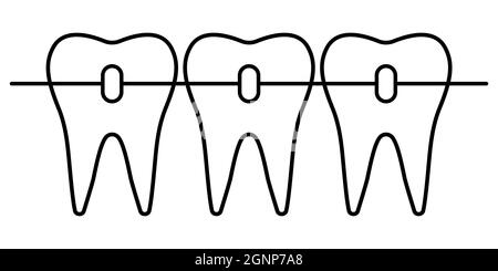 Zahnspangen Symbol, kieferorthopädische Zahnausrichtung für ein schönes Lächeln Stock Vektor