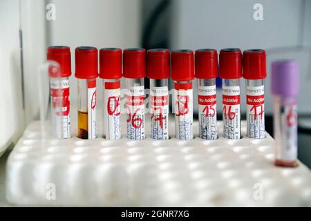 Biologie in einem afrikanischen Krankenhaus. Vacutainer-Röhrchen, die zur Blutentnahme verwendet werden. Benin. Stockfoto