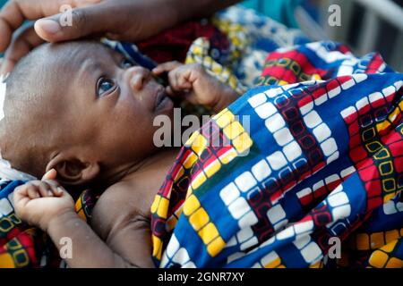 Afrikanisches Krankenhaus. Pädiatrische Station. Kind auf der Intensivstation. Benin. Stockfoto