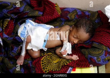 Afrikanisches Krankenhaus. Entbindungsstation. Neugeborenes Frühgeborenes. Benin. Stockfoto