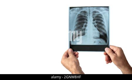 Copy Space Analyse der Lungenentzündung Foto. Der Arzt betrachtet die Röntgenaufnahme der Lunge in der Klinik, der Arzt analysiert die Lungenentzündung der Lunge Stockfoto