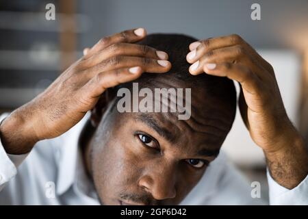 Junge Afrikanische Männer Haarausfall. Haarausfall Beobachten Stockfoto