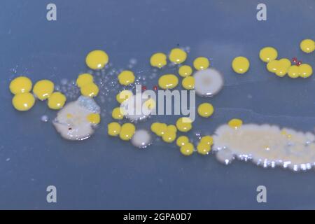 Makroansicht von Bakterien und Bäckerhefekolonien. Stockfoto