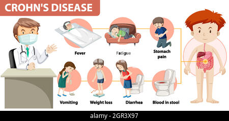 Medizinische Infografik der Morbus Crohn Stock Vektor