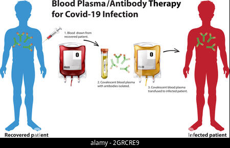 Infografik zur Blutplasma-/Antikörpertherapie für Covid-19-Infektionen Stock Vektor