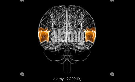 Gehirn posteriorer Teil des rechten oberen temporalen Gyrus Anatomie für Medical Concept 3D-Illustration Stockfoto