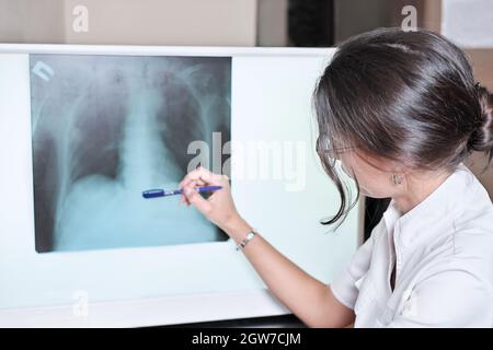 Arzt Überprüfung Brust Röntgenbild der Brust. Junge Brünette Frau Radiologin zeigt auf eine Lunge Röntgenbild auf einem Bildschirm. Lungen-Scan in der Radiologie-Abteilung Stockfoto