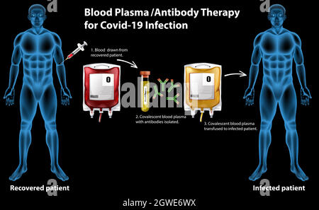 Infografik zur Blutplasma-/Antikörpertherapie für Covid-19-Infektionen Stock Vektor