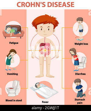 Medizinische Infografik der Morbus Crohn Stock Vektor