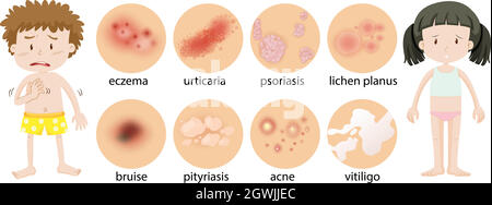 Kleine Kinder mit unterschiedlichen Hautzuständen Stock Vektor