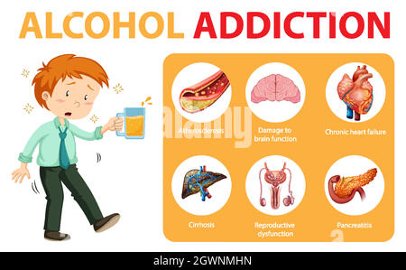 Infografik zu Informationen zu Alkoholabhängigkeit oder Alkoholismus Stock Vektor