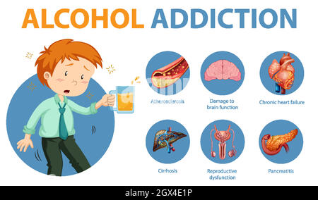 Infografik zu Informationen zu Alkoholabhängigkeit oder Alkoholismus Stock Vektor