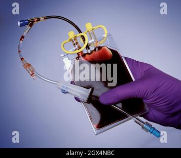 Beutel zur Entnahme von Nabelschnurblut Stockfoto