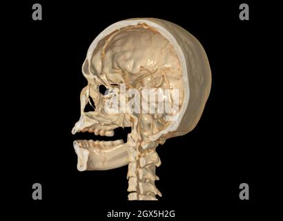 Eine Horde des Schädels 3D, die das Gehirn im Schädel zeigt. . Stockfoto