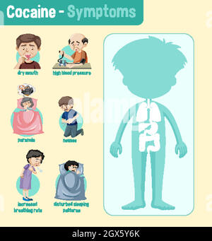 Infografik zu den gesundheitlichen Auswirkungen von Kokain Stock Vektor