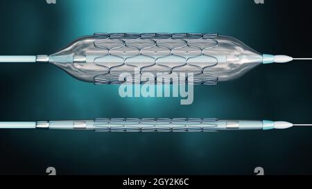 Bereitgestellter und zusammengeklappter, für die Angioplastie bereitgestellter, auf einem blauen Hintergrund aufbereiteter 3D-Rendering-Illustration. Medizin, Chirurgie, Kardiologie, Medizin, Wissenschaft, te Stockfoto