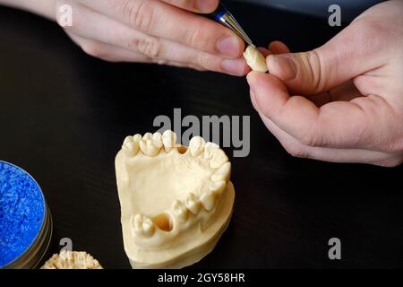 Der Zahntechniker beschäftigt sich mit der Modellierung von künstlichem Zahnersatz. Qualitätskontrolle des Zahnhalses. Stockfoto