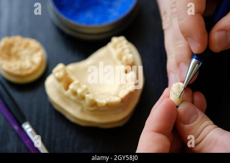 Der Zahntechniker beschäftigt sich mit der Modellierung von künstlichem Zahnersatz. Qualitätskontrolle des Zahnhalses. Stockfoto