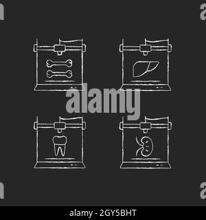 Dreidimensionale bioprinting Kreide weiße Symbole auf dunklem Hintergrund gesetzt Stock Vektor