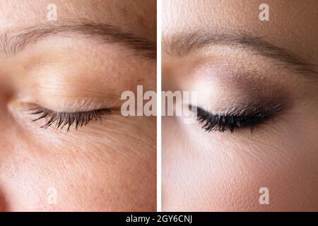 Frau Gesicht Haut Make-Up. Vorher Und Nachher Vergleichen Stockfoto