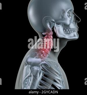 3D Rendering eines Skeletts mit Halswirbelknochen hervorgehoben Stockfoto