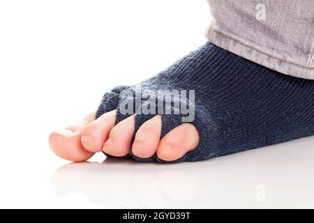 Bunion, Hallux valgus. Separator Socken auf weißem Hintergrund. Stockfoto