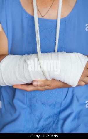 Ältere Frau mit einem zurückgewickelten Arm in einer Besetzung und einem Verband. Schlag, Bruch, Knochen, Krankenhaus Stockfoto