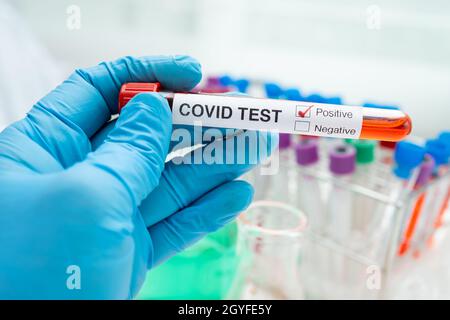 Positive Blutinfektionsprobe im Reagenzglas für Covid-19-Coronavirus im Labor. Wissenschaftler hält an, um den Patienten im Krankenhaus zu überprüfen und zu analysieren. Stockfoto