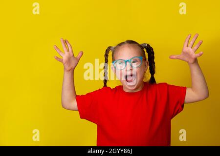 Glückliches Mädchen mit Down-Syndrom. Spaß haben, lachen. Lustige Zöpfe. Studio. Porträt auf gelbem Hintergrund Stockfoto