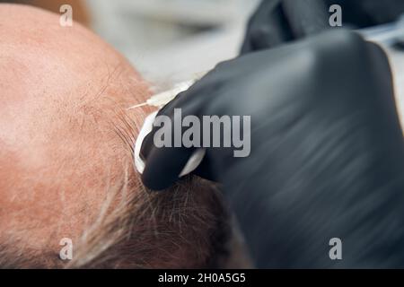 Kosmetikerin Hände machen Injektion in Mann Kopf Stockfoto