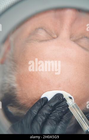 Kosmetologe Hände machen Injektion in die Stirn des Menschen Stockfoto