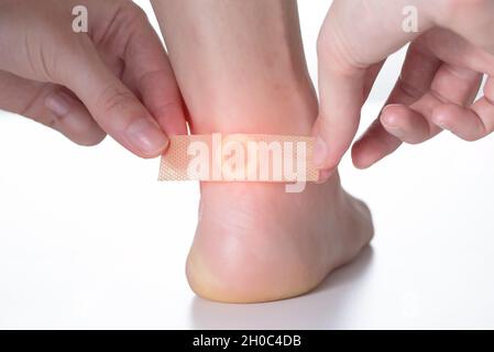 Eine Frau klebt einen medizinischen Pflaster zur Behandlung von Warzen auf den Fuß. Nahaufnahme, Problem Stockfoto