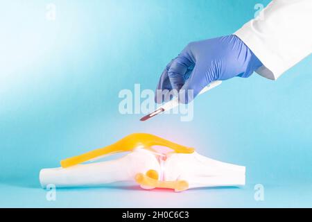 Der Arzt hält ein Skalpell in der Nähe des Kniegelenks auf einem blauen Hintergrund. Konzept Kniechirurgie, Kreuzbandersatz, Meniskuschirurgie. Stockfoto