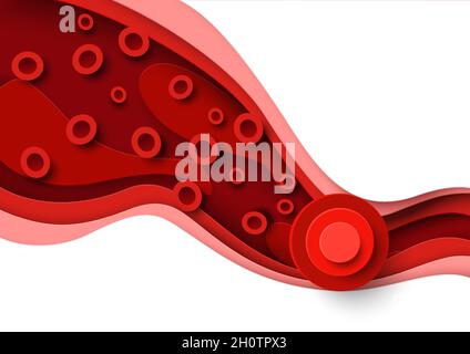 Blutgerinnsel, Thrombus in der Vene, Arterie, Vektorpapier Schnitt Illustration. Arterielles Gerinnsel, tiefe Venenthrombose. Medizinisches Poster Stock Vektor