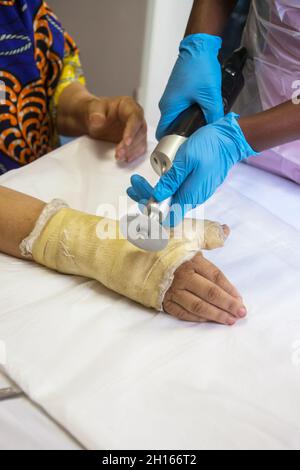 Kaukasische Frau mit gebrochenen Händen Krankenschwester Entfernen der Besetzung Stockfoto