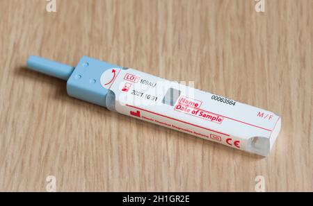 Großbritannien - 21. April 2021. Stuhltest (FITEALER oder fäkaler immunochemischer Test), ein Stuhl-okkulter Bluttest zum Screening von Darmkrebs aus einer Stuhlprobe Stockfoto
