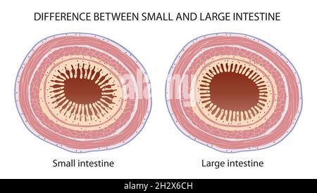 Unterschied zwischen Dünndarm und Dickdarm Stockfoto