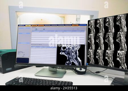 MRT-Scan Kontrollraum und Computer mit Untersuchung der Halswirbelsäule, Konzept der Medizintechnik Stockfoto