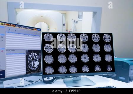 CT Scan Kontrollraum und Computer mit Gehirnscan, Medizintechnikkonzept Stockfoto