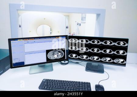Computermonitor Scan Kontrollraum und Computer zeigt Abdominalscan, Medizintechnikkonzept Stockfoto
