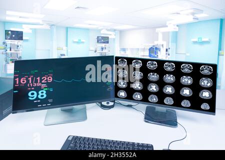 Bewegungsunschärfe in der Notaufnahme Krankenhaus, ein Monitor, der Vitalparameter zeigt, und MRT-Hirnscan , Medical Healthcare Konzept. Stockfoto