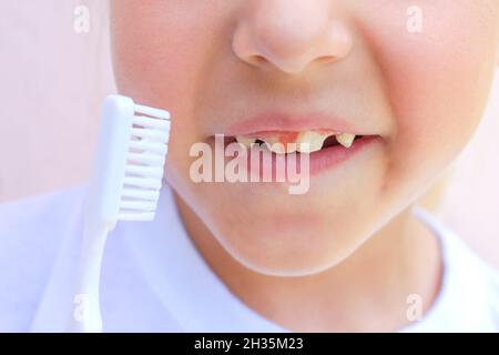 Blut auf den Zähnen eines Kindes. Stockfoto