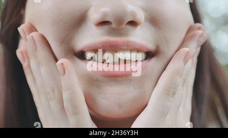 Ein junges Mädchen lächelt und zeigt ihre schiefen Zähne. Stockfoto