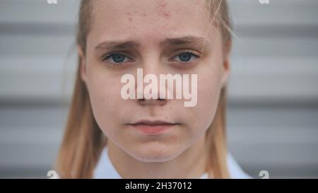 Porträt eines 15-jährigen Teenagers. Nahaufnahme des Gesichts. Stockfoto