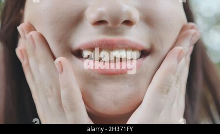 Ein junges Mädchen lächelt und zeigt ihre schiefen Zähne. Stockfoto