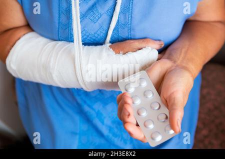 Eine ältere Frau im Ruhestand mit einem zurückgewickelten Arm in einem Guss und einem Verband hält Anäschetabletten. Schlag, Bruch, Knochen, Krankenhaus | Modellzulassung vorhanden Stockfoto