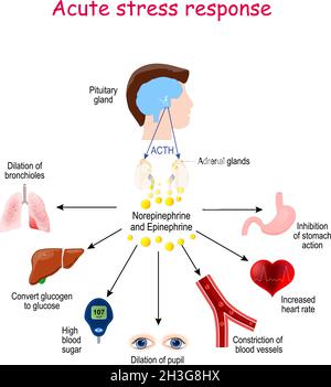 Akute Stressreaktion. Reaktion des endokrinen Systems. Hormone (Noradpinephrin, Epinephrin, ACTH) und Zielorgane (Herz, Lunge, Leber, Augen, Blut Stock Vektor